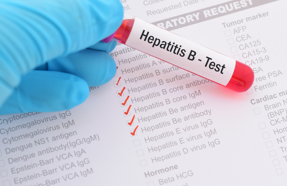 Vakcina protiv Hepatitisa B